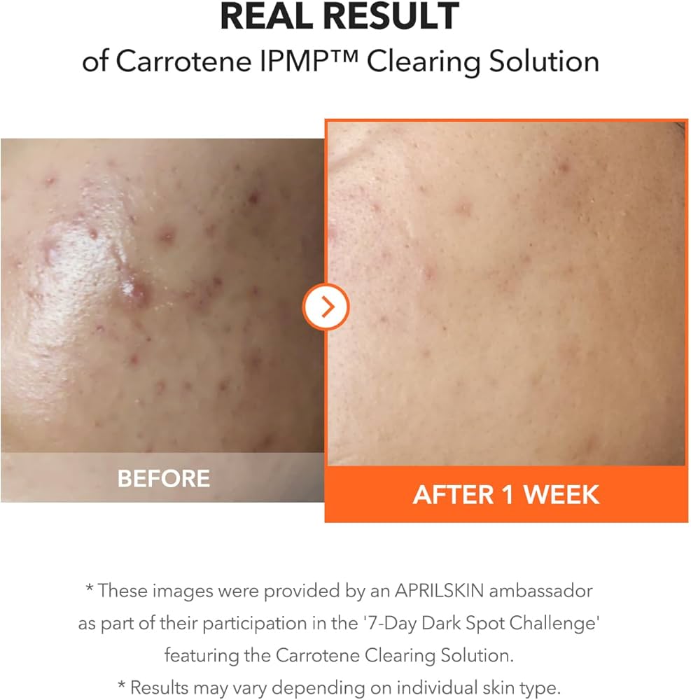 Solución limpiadora de APRILSKIN Carrotene IPMP #CodO