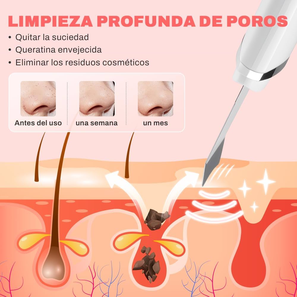 Paleta ultrasónica