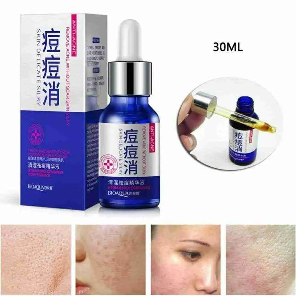 Serum anti acné Biaqua