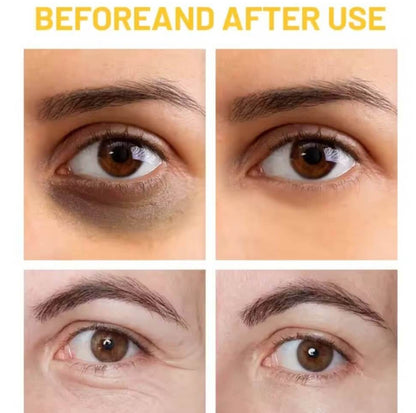 Contorno de ojos Disaar Mucina de caracol #CodL