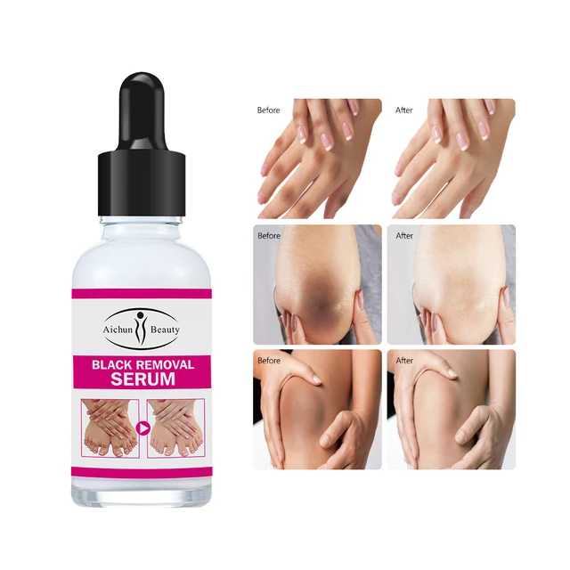 Sérum aclarante Aichun Beauty #CodL